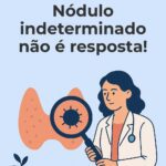 nódulo